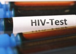 What is the process for HIV prevention and treatment in Singapore?