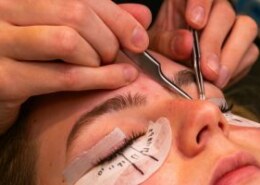 Pigmentation Treatment in Singapore: Effective Solutions for Clearer, Brighter Skin