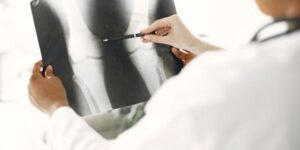 #arthroscopic knee surgery Singapore